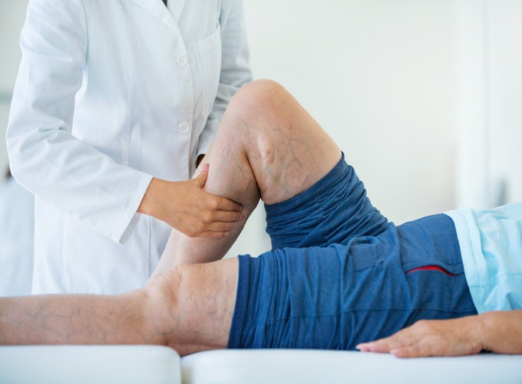 The Connection Between Vein Treatments and Overall Health